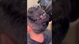 TED Hair Restoration [upl. by Rocker]