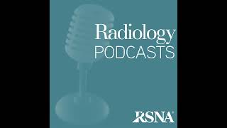 Y90 Radiation Segmentectomy for HCC [upl. by Justine]