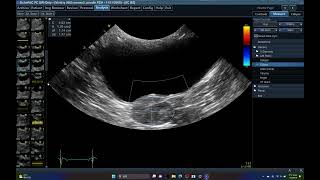 5565 CRYPTORCHIDISM  ECHOPAC ANALYSIS HIDDEN TESTIS ABDOMINAL ULTRASOUND DOG [upl. by Odelet157]