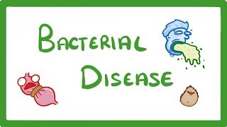 GCSE Biology  What Are Bacterial Diseases  Treatment and Prevention 37 [upl. by Pendleton]