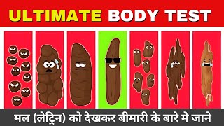 12 ज़रूरी बातें जो हमारा मल बताता है हमारी सेहत के बारे में  Things Stool Says About Your Health [upl. by Seedman]