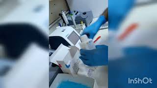 پشکنینی زەردوویی بەڕێگەی مانیۆلBilirubin TotalDirectampindirectjaundice [upl. by Anniahs515]