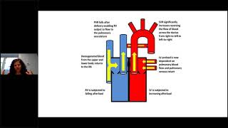 202203  R Ghandi  Neonatal circulation and central lines [upl. by Nicole]