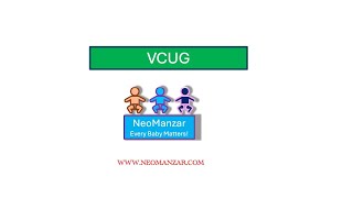 VCUG in a newborn infant [upl. by Zigmund]