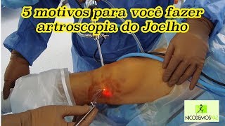 Bloqueio dos nervos sensitivos do joelho  tratamento para artrose [upl. by Arammat]