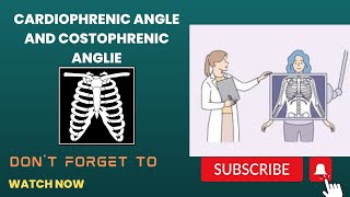 costophrenic and cardiophrenic angle and lungs zone [upl. by Pettiford]