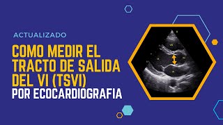 📏Cómo medir el 🎯TRACTO DE SALIDA DEL VENTRÍCULO IZQUIERDO TSVI por ecocardiografía Actualizado [upl. by Aelsel]