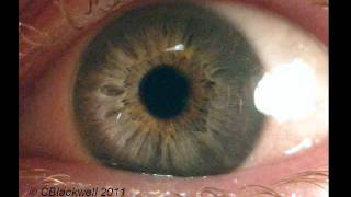 Eye Works 1 Focusing Cornea Iris and Lens [upl. by Showker]