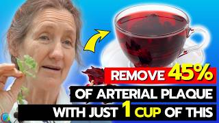 Clear CLOGGED ARTERIES Instantly  Barbara Oneill Reveals The 1 SOLUTION To Change Your Life [upl. by Cesaro]