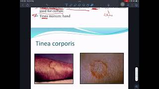 شرح Mycology Dermatophytes 1 [upl. by Esertap]