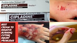 BEST OINTMENT TO TREAT FORBURNINGCUTINGINJURY PAINSCIPLADINE OINTMENT FULL REVIEW IN TELUGU USES [upl. by Rochester]