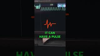 Ventricular Tachycardia EMS Call [upl. by Attenat567]