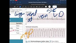 Physical examination of cardiovascular system 2 [upl. by Langdon349]