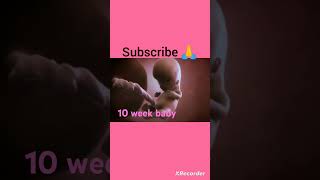 10 week baby in wombpregnancy ultrasound baby [upl. by Aysahc]