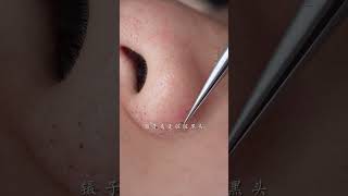 immersive skin care strawberry nose blackhead deep pore cleaning skin management [upl. by Eannaj]