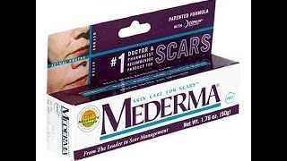 Mederma cream review  mederma cream  mederma advanced scar gel review [upl. by Acnoib781]