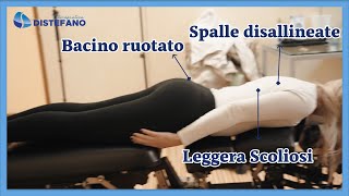 Risolvere Sindromi Posturali con la Chiropratica [upl. by Eskill304]