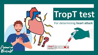 TropT test  What if Trop T test is positive  Troponin T blood test [upl. by Nnylarac]