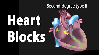 Heart Blocks Anatomy and ECG Reading Animation [upl. by Powers]