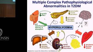 61518 Diabetes amp CVD Have We Found the Holy Grail [upl. by Chelton]