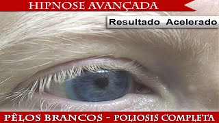 Ter pêlos totalmente brancos  Poliosis Completa【Hipnose Avançada Biokinesis】 [upl. by Llertnod132]