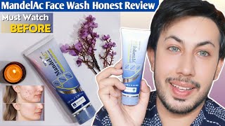 jenphram Mandelic Acid Facewash Review  Mandelic Acid Cleanser [upl. by Millham]