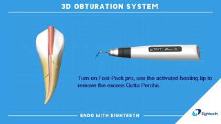 How to Use Eighteeth Obturation System FastPack FastFill Continuous Wave Compaction WVC [upl. by Amalberga]