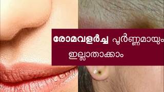 രോമവളര്‍ച്ച പൂർണ്ണമായും ഇല്ലാതാക്കാം Facial Hair Removal Home Remedy [upl. by Drawd]