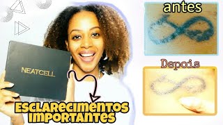 COMO REMOVER TATUAGEM EM CASA 2° SESSÃO  CANETA NEATCELL [upl. by Rebecca]