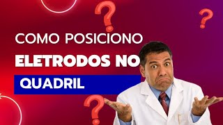 Como posicionar eletrodos no quadril [upl. by Koerlin]