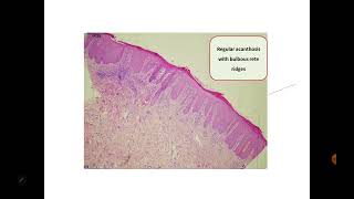 Dermpath3 Dr Rania Elakad [upl. by Krigsman]