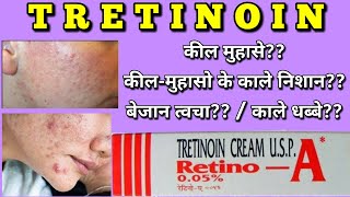 Tretinoin cream  Retino A cream uses side effects how to apply [upl. by Llerrehs]