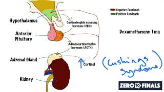 Understanding The Dexamethasone Suppression Test [upl. by Hogan789]