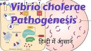 Vibrio cholerae  Pathogenesis amp clinical manifestations [upl. by Neveda]