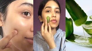 I USED ALOE VERA GEL ON MY FACE FOR 3 WEEKS AND THIS IS WHAT IT DID TO MY SKIN [upl. by Rivalee]