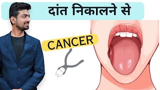 Daant Nikalne se Cancer Hota Hai Expert Reveals the TRUTH [upl. by Bracci]