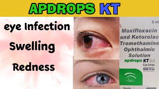 apdrops kt 04 eye drops uses  moxifloxacin ketorolac tromethamine eye drops [upl. by Yerfej]