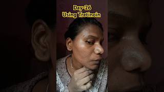 Day26 Using Tretinoin 0025 cream viralvideo tretinoin shorts skincare youtubeshorts [upl. by Llertrac818]