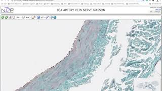 Artery vein and nerve massons stain histological slide [upl. by Ocnarfnaig]