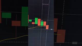 RGRG Patterns BinaryOptions QuotexTrading TradingStrategy MakeMoneyOnline FinanceTips Invest [upl. by Mimi]