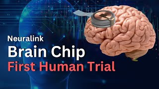 First Neuralink Brain chip Implanted Whats Next [upl. by Fanchie940]