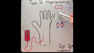 Type 2 hypersensitivity reaction in 2 mins [upl. by Semyaj493]