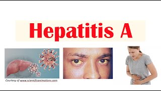 Hepatitis A  Virus Risk Factors Pathophysiology Signs amp Symptoms Diagnosis Treatment [upl. by Leiad850]