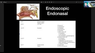 Extended Endoscopic Endonasal Approach For Clival Chordoma  Professor Selfy Oswari [upl. by Gilberte]