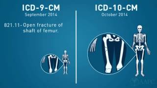 What is ICD10 [upl. by Davidson]