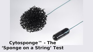 Cytosponge™  The ‘Sponge on a String’ Test [upl. by Akahc342]