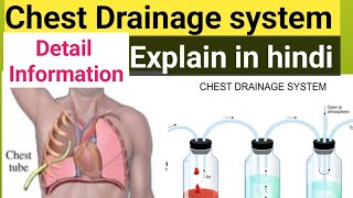 chest Drainage system explain in hindi water seal drainage system youtubeviralvideoyoutuber [upl. by Wardieu]