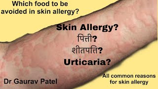 Skin allergy in hindi urticariaपित्ती शीतपत्ति causesfood and other allergen Dr Gaurav patel [upl. by Aihtenak712]