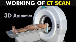 Working Of CT Scan 3D Animation UrduHindi [upl. by Haidabez]