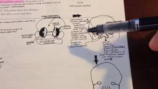 Cleft lip and palate USMLE Step 1 [upl. by Cyrie]